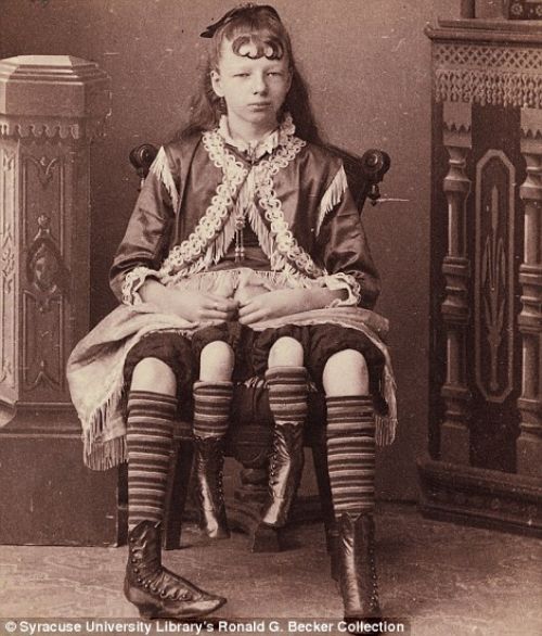 blog historia, historia cyrku, dawne pokazy, karły, albinosi, obyczajowość XIX wiek