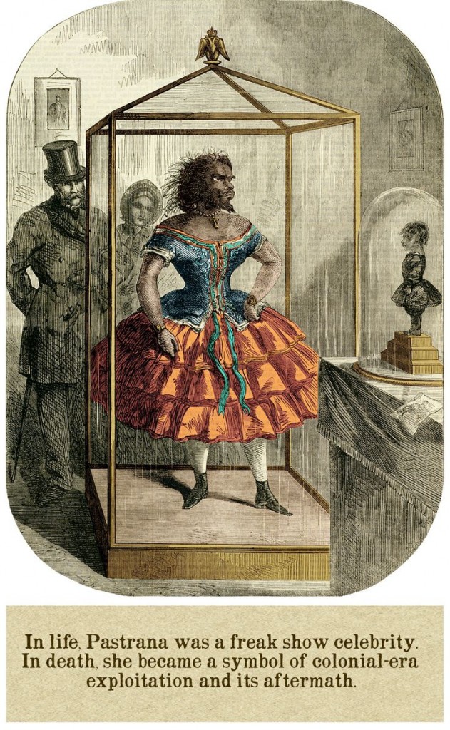 ludzie pokazywani w cyrkach i na wystawach w XIX w.